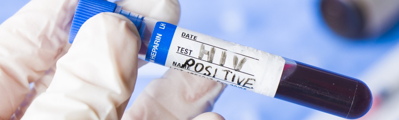 gloved hand holding test tube marked HIV Positive