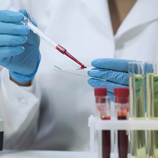 lab working performing blood test, test tubes of blood